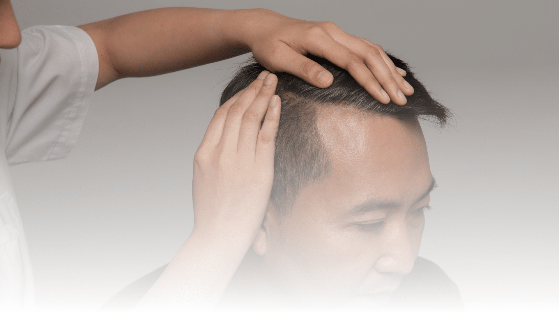 Doctor parting man's hair for hair loss Hair Treatment in Los Angeles